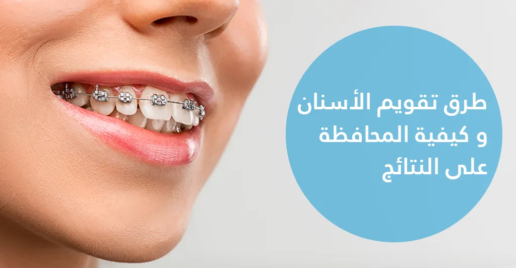 طرق تقويم الأسنان و كيفية المحافظة على النتائج